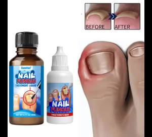 Liangjia Fungal Nail Care Set Nourishing Repair Oil Softens Thick Toenails & Fingernails Daily Cleaning Care for Nail Health