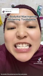 bodyaid toothpaste pemutih gigi kuning teeth whitening ubat gigi  pemutih kuning  niacinamide body aid kuning tartar美白牙膏