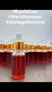 15ml Kasoy Oil Warts Remover Legit Original Effectively Removes Warts Skintags Moles & Kulogo by Zamurra