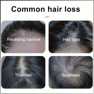 Hair Care Essence Moisturize the Scalp Hydrating Texture Serum Hair Loss Prevention and Hair Care