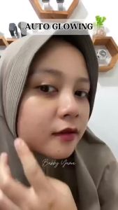 Ertos Niacinamide Plus Serum: Produk Penyamarkan Bekas Jerawat Terbaik