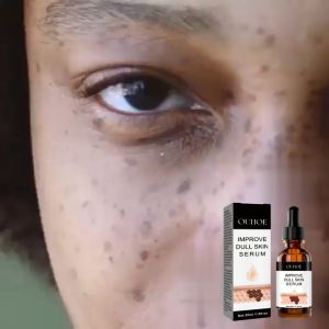 ouhoe   Facial care - Dark spot repair facial serum brighten skin soften keratin remove dark spots lighten melanin and improve dull skin.