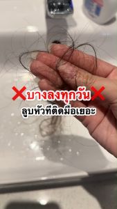 YANHEE TEEZEER ANTI HAIR FALL CONTROL SERUM ของแท้ ส่งไว ถูกสุด ยันฮี ทีเซอร์ เซรั่ม บำรุงเส้นผม ลดผมร่วง กระตุ้นผมงอกใหม่