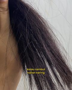 Lume Scalp Hair Therapy Shampoo Anti Ketombe Rambut Rontok Kering Lepek Dan Gatal Non Sulfat SLS