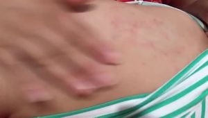 💗🙋♀️💗张氏抑菌王皮肤抑菌膏止痒膏软膏脚气膏脱皮膏草本皮肤外用乳膏