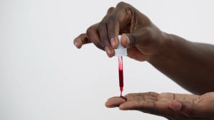 The Ordinary AHA 30% + BHA 2% Peeling Solution: Pore Minimizer & Blackhead Remover