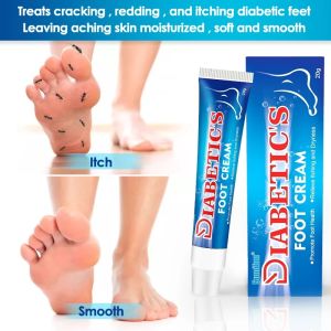 20g Natural Extract Diabetic Foot Cream Fast Absorption Release Itchy Foot Treatment Anti Inflammation
