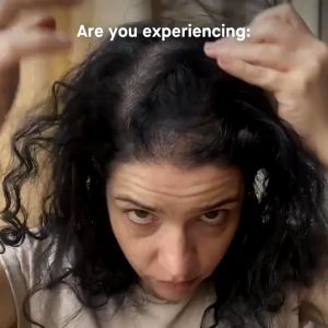 Esensi Pertumbuhan Rambut: Rambut Rontok Perawatan Rambut Rambut Rontok Pria Hair Growth Serum Jahe Serum Anti Botak Rambut Memperbaiki Tekstur Rambut Mempercepat Penumbuhan Rambut