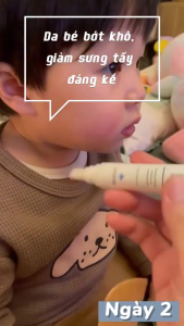 Kem làm dịu da nhanh chóng cho trẻ sơ sinh Sos Cream Thương hiệu Atono2 Hàn Quốc