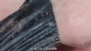 พร้อมส่ง มาส์กลอกสิวเสี้ยน สิวหัวดำ ดีทอกซ์ ทำความสะอาดลึกถึงรูขุมขน ขจัดสิวเสี้ยน ได้หมดจด บำรุง 60g สำหรับทุกสีผิว