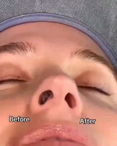 【Ready Stock】Portable Nose Hair Trimmer Waterproof Rechargeable Razor Facial Cleaner Womens Shaving And Hair Removal Tool PhIeo