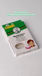 Mentholatum Acne Cover | Acne Patch | Acne pimple Acnes 26pcs (Contains anti-bacterial & pimples heal faster)