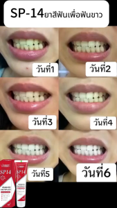 👍แวววาว👍SP-6ยาสีฟัน ยาสีฟันฟันขาว ฟอกสีฟัน ยาสีฟันขจัดปูน ยาสีฟันขจัดหิน น้ำยาฟอกฟันขาว 120g Toothpaste ลดกลิ่นปาก