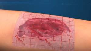 PolyMem MAX แผ่นดูดซับแผล แผลกดทับ แผ่นแปะแผล โพลิเมม ดูดซับพิเศษ ขนาด 11 x 11 cm (แบบชิ้น)