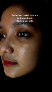 Buy 1 Get 1 Amei Exfoliating Gel Mengangkat Sel Kulit Mati DNA Salmon Bisa Digunakan Pria Dan Wanita