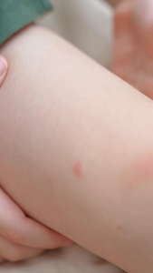 Zambuk Ointment 8gr 25gr / Salep Hijau Untuk Gatal Gigitan Nyamuk Serangga Memar Benjol / BANDUNG