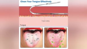 U Shape Tongue Scraper Cleaner Stainless Steel Oral Removes Bacteria Cleansing Tool Dental Hygiene Care Bad Breath