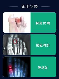 Adjustable Hammer Toe Straightener And Corrector For Metatarsalgia Claw Toe Mallet Toe Pain Relief Splint Foot Compression Wrap