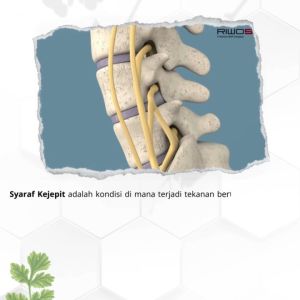 REMAFOST BHARATA Obat Herbal Rematik Asam Urat Radang Sendi Tulang Neuritis Saraf Kejepit