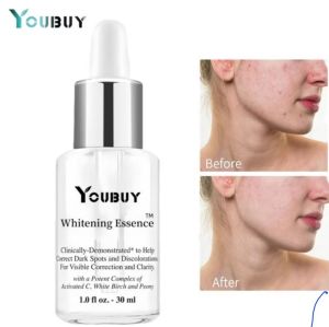 20g CREAM WAJAH whitening blemishe salep melasma salep flek dark spot Whitening n frecle removing Cream