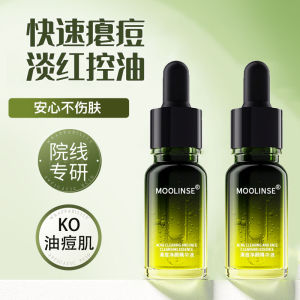 Acne Treatment Essence Oil Control Pore Minimizing Moisturizing Soothing Clear Skin Serum for All Skin Types Anti-Oxidant