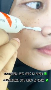 [BPOM] Cindynal Whitening  Niacinamide Skin Cream Remove  Penghilang   Membandel Anti  Bintik noda/ Jerawat Fuyan