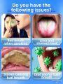 Severe Bad Breath Removal Oral Freshener Yellowing Stain Removal Toothpaste. 