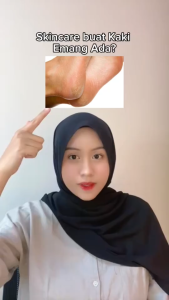 Nita Skincare - Kanna Krim Kaki Krim Lembut Menagatasi Tumit Pecah Kaki Kasar Kulit Pecah