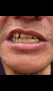 COD Pasta Gigi Charcoal- Memutihkan Gigi dan Membersihkan Karang Gigi - Odol Pemutih Gigi - Menghilangkan Bau Mulut - Pasta Gigi Herbal Non Paraben Aman Dipakai Tiap Hari，Toothpaste Whitening Pasta Gigi Whitening Pemutih Gigi，​Pembersih Karang Gigi