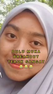 Vitamin C Glow Skin Whitening Felle White Pemutih Badan Seluruh Cepat Supplement Full Body Ubat Putih Satu Badan Berkesan Untuk Lelaki Dan Wanita 5 Capsule