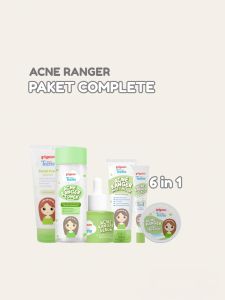 Pigeon Teens Paket Kecantikan Acne Ranger Complete Set Isi 6 item