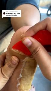 Tumitku Obat Kaki Pecah2 - Salep Krim Obat Masker Kaki Pecah2 Dan Kering Parah Yg Ampuh Pembersih Penghalus Tumit Pecah Mengelupas