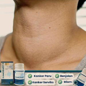 KAMORAFIT [Paket 3 Botol] - Obat Benjolan Lipoma - Kamorafit Herbal Obat Benjolan Tubuh BPOM Halal