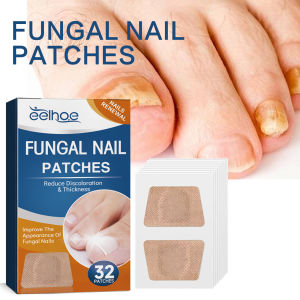 32Pcs/Box Universal Nail Ditch Repair Patch Compact Nail Repair Stickers Ingrown Toenail Correction Sticker Foot Care