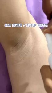 Deodorant Spray BPOM - Penghilang Bau Ketiak AMPUH 60ml