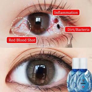 Eye Drop Relieve Red Blood Shot Eye Care Solution 15ml Continuously Moisturizing Relieve visual fatigue dry eyes Eyestrain Itchy eyes Gentle and non-irritating eye care