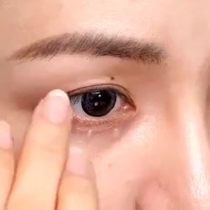 LYDIMOON Eye Cream Serum Dark Circles Remover 30G remove puffy eye fat granule brightening eye essence moisturizing lifting firming anti wrinkle