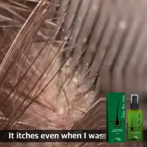 OUHOE Natural Hair Growth Spray Hair Strengthens Solution Moisturizes Hair Roots Growth Thick Dry Hair Repair Oil Fast Growing Germinal Liquid For Men Women(120ml)