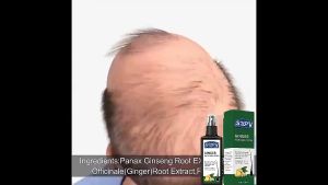 头发增长喷雾Hair growth spray anti-hair loss and solidification to promote hair growth 120ml herbal hair growth care essence spray for men and women