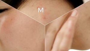 Sữa Rửa Mặt COSRX Dạng Gel Low pH Good Morning 150ml Chiết Xuất Tràm Trà Dành Cho Da Dầu Mụn