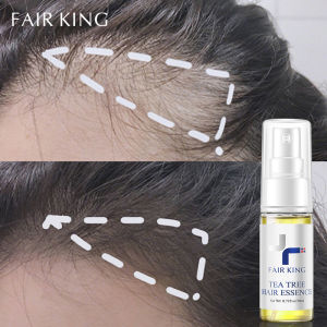 FAIR KING Tea Tree Hair Growth Essence Hair Loss Products Preventing Hair Loss Make Hair Smoother Oil 20ml