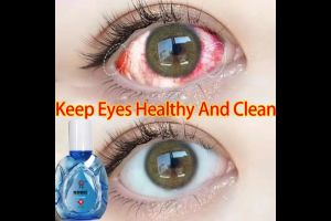 Eye Drops for Eye Care15ml/Brand Eye Drops/mineral eyedrops/Eye Drops Artificial Tears Improve Eyesight Eye Drops Itchy Eyes Lubricant & Rewetting Eye Drops Dry Eye Visual Fatigue Relieve and Protect Eyesight 本草眼滴液 视力王熊胆液 滴眼液 眼痒 缓解眼睛疲劳 护眼 护眼液 眼睛干涩