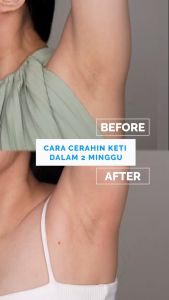 Brighty Underarm Scrub Microscrub Pencerah Ketiak Selangkangan Lipatan Hitam Permanen Eksfoliasi Kulit Mengurangi Kerutan Dan Garis Halus Scrub Tubuh Bpom