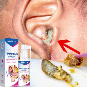 Ubat Telinga Ear Cleaner Spray Tinnitus Relief Spray Ubat 30ml telinga Ear Wax Remover Pus-flowing Treat 耳鸣 滴耳液