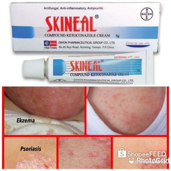 SKINEAL CREAM | Lazada