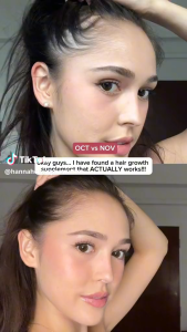 Spot Nourkrin HAIR GROWTH+ INCLINIC 90 Tablets 生发胶囊