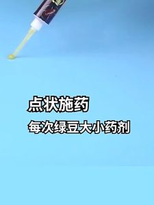 Germany Bayer Cockroach Nest and Drug Bayer Worship Destroyed Disabilities Kill Cockroach 杀蟑螂药家用一窝全窝厨房灭蟑正品非无毒屋胶饵剂强力小强蟑螂药 German Cockroach Killer Cockroach Killing Bait - Lazada