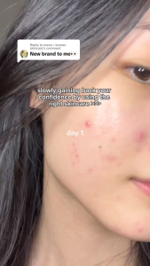 Authentic In-Stock — Recommended by Beauty Salons: Bodie Whitening Freckle Removing Cream Moisturizing Whitening Cream Brightens Skin Tone Removes Yellowing Skin-Brightening Spot-Removing Face Cream Skincare Product