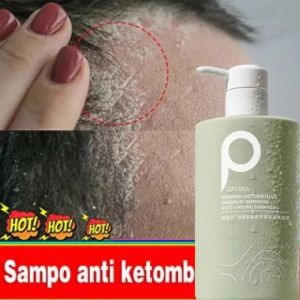 Shampo Penumbuh Rambut Cepat & Anti Ketombe