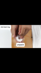 5/10Pcs Ostomy Leak Proof Ring Plastic Patch Ring Anti-Leakage Skin Protection Care Products